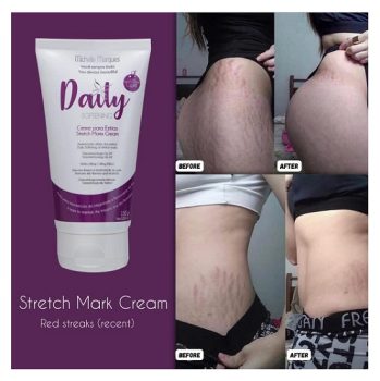 Creme para Estrias Michelle Marques – Daily, 150 g